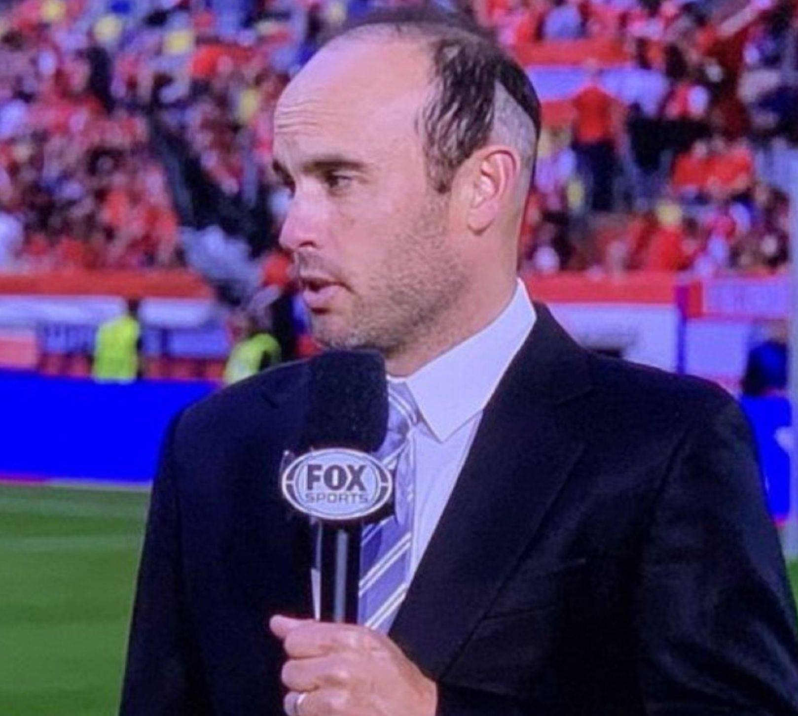 Donovan's Hair Transplant Gone Wrong, Exposed During Live Euro Coverage