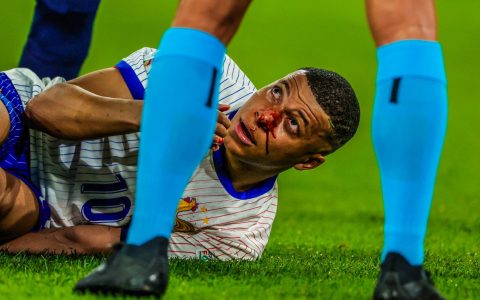 Spanish Media: Real Madrid's Medical Team Believes Mbappé's Nose Does Not Require Surgery, Rest is Recommended